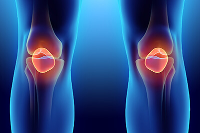 Torn Meniscus Stem Cell Treatment in Bridgewater, MA